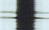 image of split absorption lines